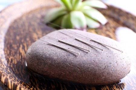 depositphotos_77586008-stock-photo-acupuncture-needles-with-spa-stone.jpg